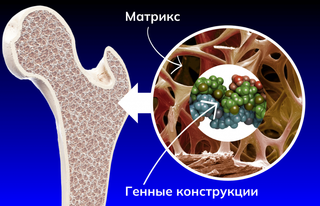 Гель восстанавливающий костную ткань